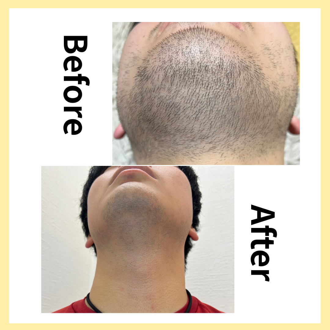 途中経過✨👀のサムネイル画像