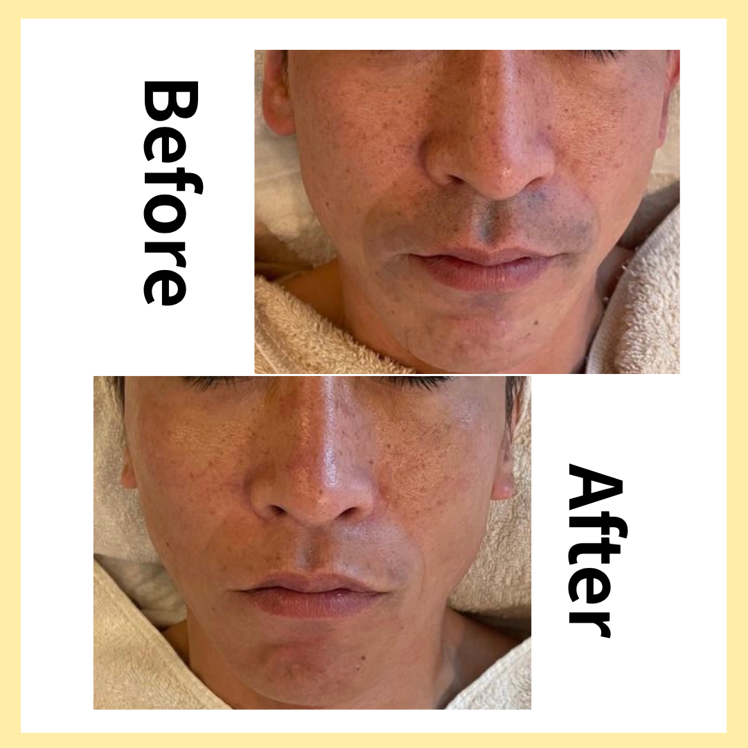 のサムネイル画像